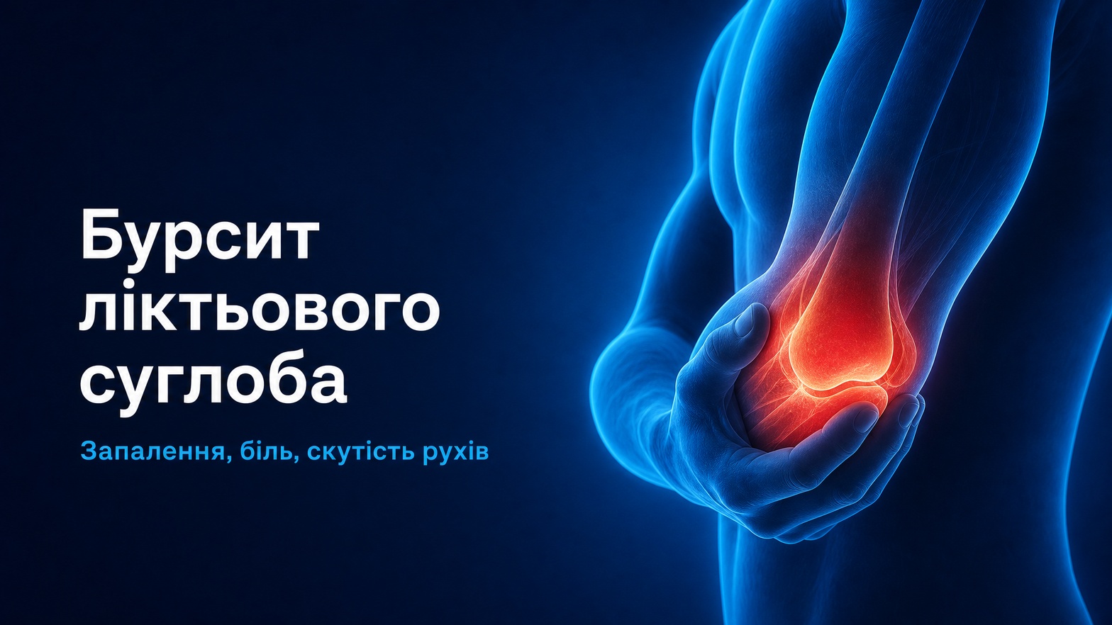 Цервікобрахіалгія — біль у шиї з іррадіацією в руку